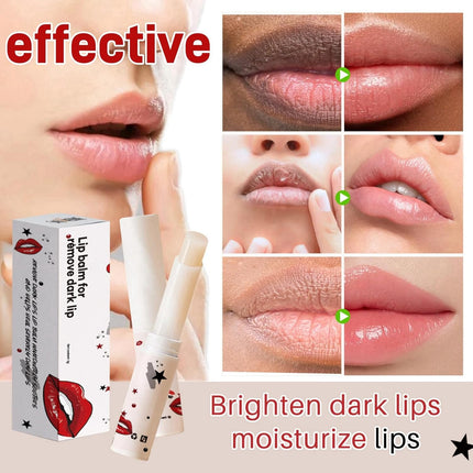 Lip Balm for Dark Lips: Moisturizing Lip Treatment for Dark Pigmented Lips in India